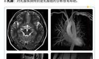 【重要通知】西门子1.5T磁共振开机仪式顺利举行