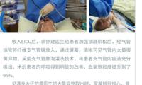【中医院故事】重症技术—异物窒息，床旁纤支镜来帮忙