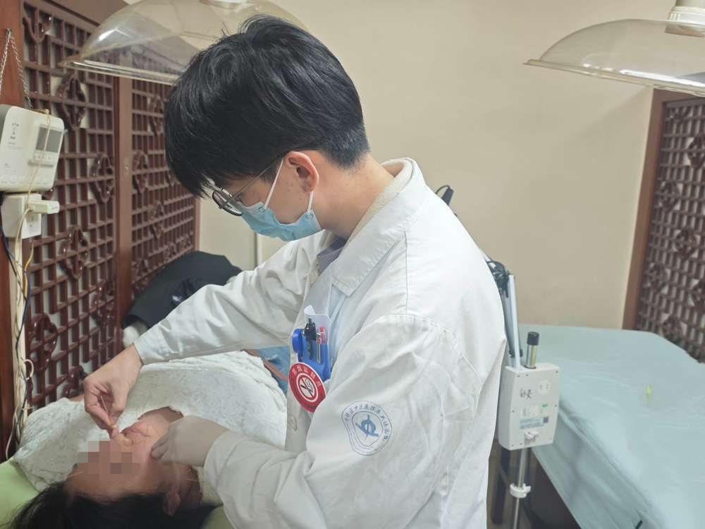 2月17日（大年初一）上午，针灸科医生毛伟东为面瘫患者针灸
