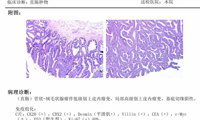 【中医院故事】便血三年，一直当痔疮？医生呼吁：务必早筛早诊